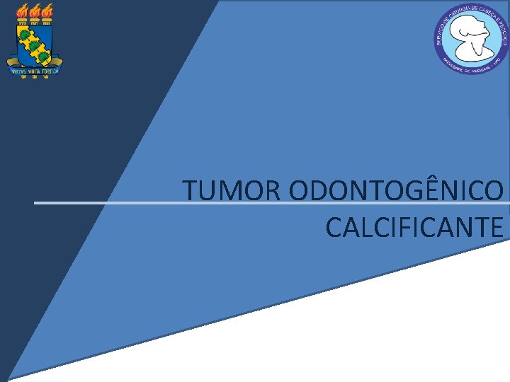 TUMOR ODONTOGÊNICO CALCIFICANTE 