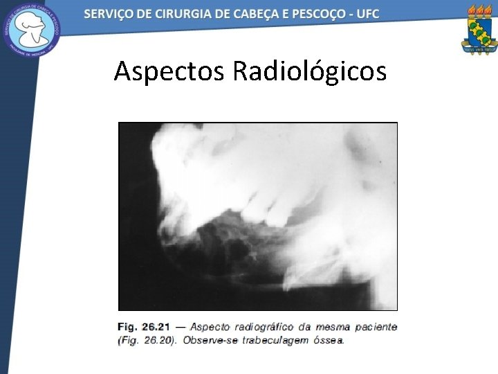 Aspectos Radiológicos 