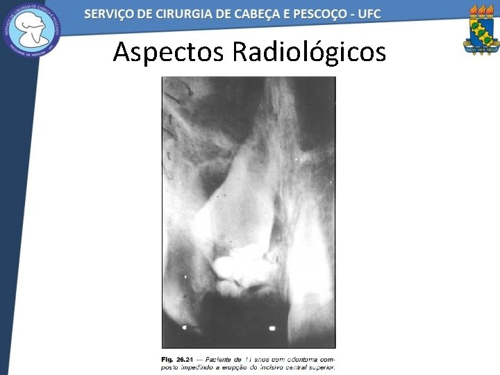 Aspectos Radiológicos 