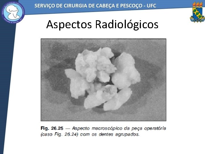 Aspectos Radiológicos 