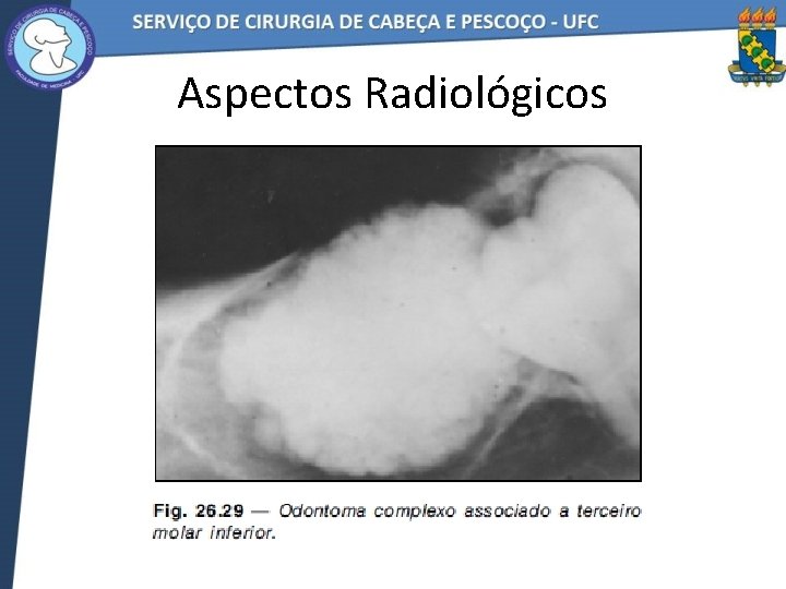 Aspectos Radiológicos 