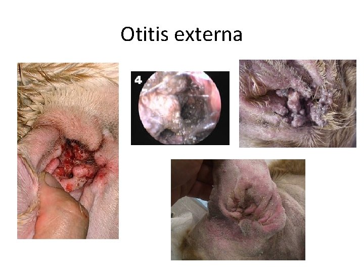 Otitis externa 