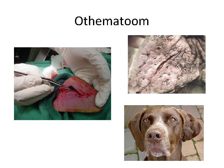 Othematoom 