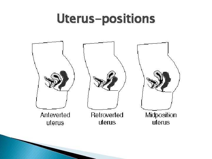 Uterus-positions 