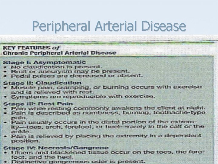 Peripheral Arterial Disease 