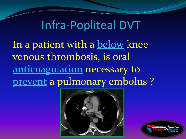 Infra-Popliteal DVT In a patient with a below knee venous thrombosis, is oral anticoagulation