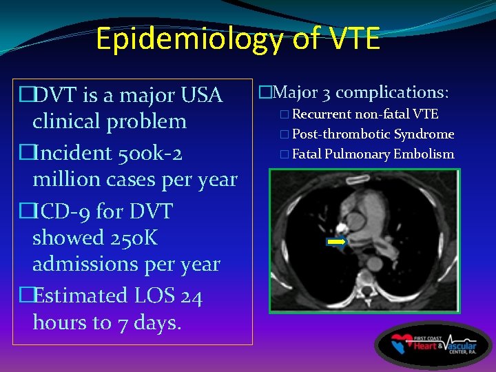 Epidemiology of VTE �Major 3 complications: �DVT is a major USA � Recurrent non-fatal