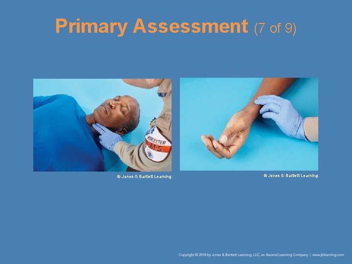 Primary Assessment (7 of 9) © Jones & Bartlett Learning. 