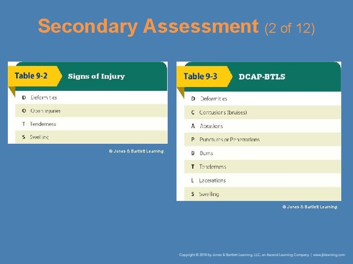 Secondary Assessment (2 of 12) © Jones & Bartlett Learning. 