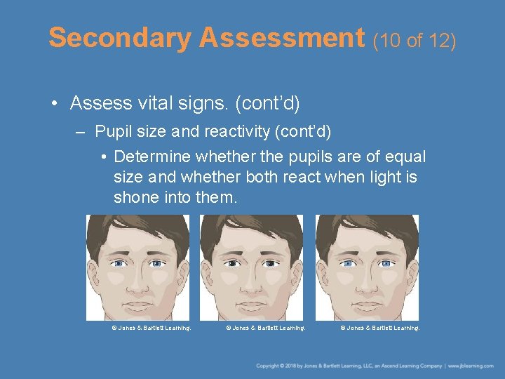 Secondary Assessment (10 of 12) • Assess vital signs. (cont’d) – Pupil size and