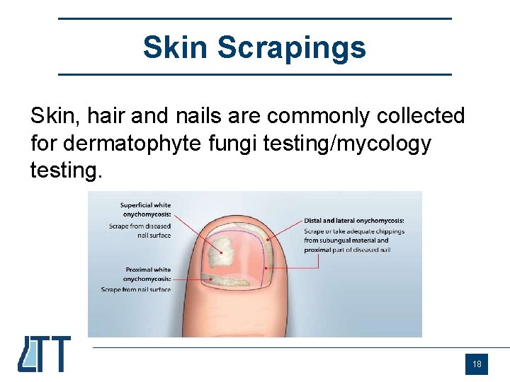 Skin Scrapings Skin, hair and nails are commonly collected for dermatophyte fungi testing/mycology testing.
