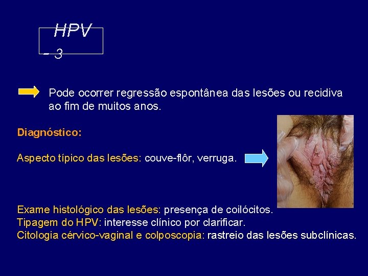 HPV -3 Pode ocorrer regressão espontânea das lesões ou recidiva ao fim de muitos