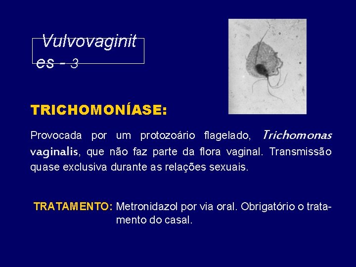 Vulvovaginit es - 3 TRICHOMONÍASE: Provocada por um protozoário flagelado, Trichomonas vaginalis, que não