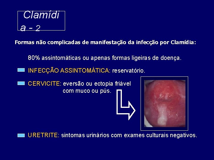Clamídi a-2 Formas não complicadas de manifestação da infecção por Clamídia: 80% assintomáticas ou