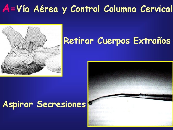 A=Vía Aérea y Control Columna Cervical Retirar Cuerpos Extraños Aspirar Secresiones 