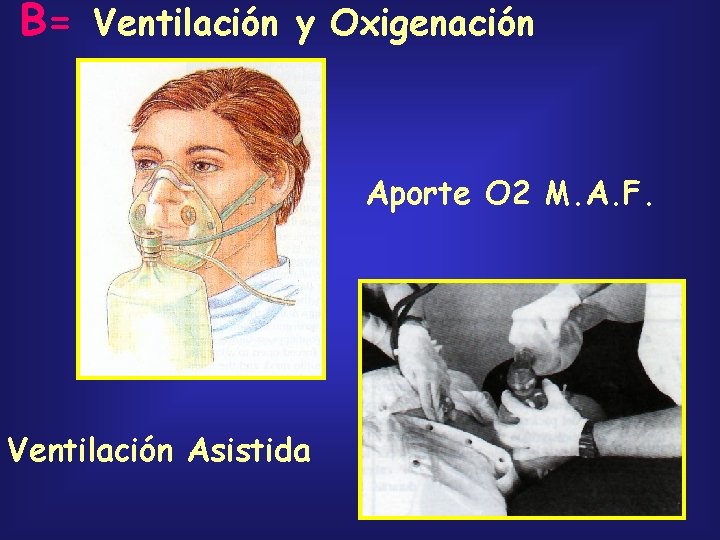 B= Ventilación y Oxigenación Aporte O 2 M. A. F. Ventilación Asistida 