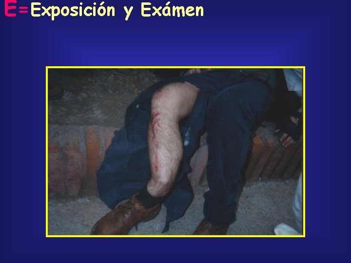 E=Exposición y Exámen 