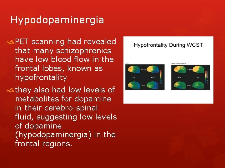 Hypodopaminergia PET scanning had revealed that many schizophrenics have low blood flow in the Hypodopaminergia PET scanning had revealed that many schizophrenics have low blood flow in the