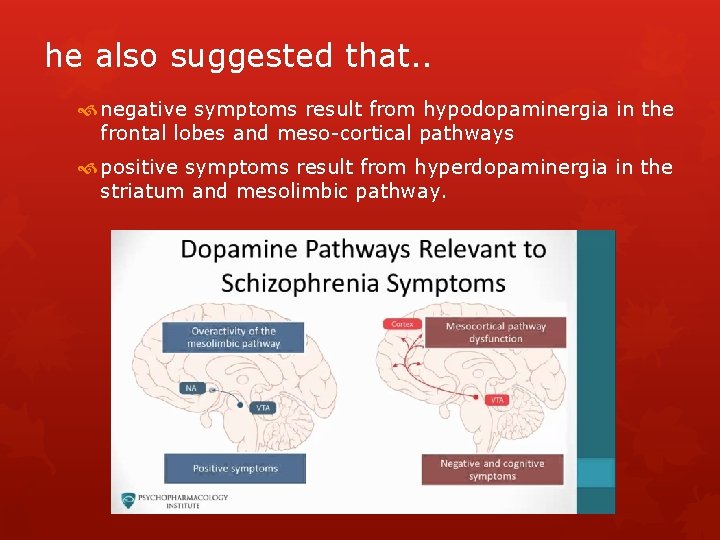he also suggested that. . negative symptoms result from hypodopaminergia in the frontal lobes he also suggested that. . negative symptoms result from hypodopaminergia in the frontal lobes