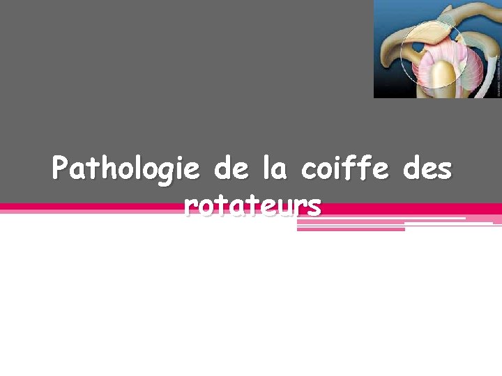 Pathologie de la coiffe des rotateurs Pathologie de la coiffe des rotateurs