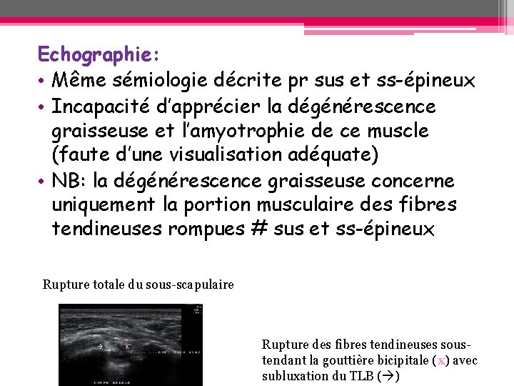 Echographie: • Même sémiologie décrite pr sus et ss-épineux • Incapacité d’apprécier la dégénérescence Echographie: • Même sémiologie décrite pr sus et ss-épineux • Incapacité d’apprécier la dégénérescence