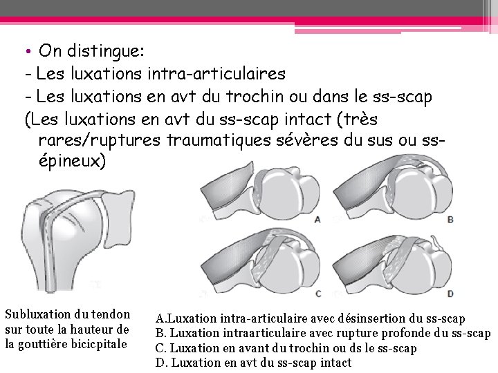 • On distingue: - Les luxations intra-articulaires - Les luxations en avt du • On distingue: - Les luxations intra-articulaires - Les luxations en avt du