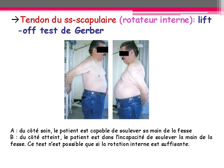 Tendon du ss-scapulaire (rotateur interne): lift -off test de Gerber A : du Tendon du ss-scapulaire (rotateur interne): lift -off test de Gerber A : du