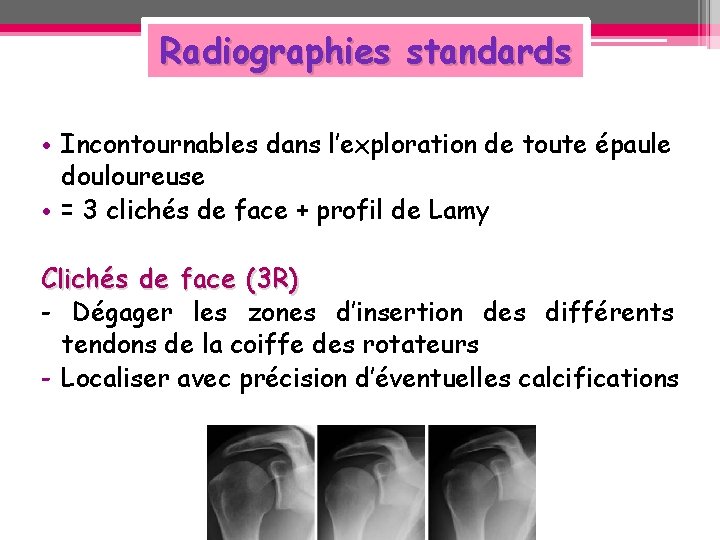 Radiographies standards • Incontournables dans l’exploration de toute épaule douloureuse • = 3 clichés Radiographies standards • Incontournables dans l’exploration de toute épaule douloureuse • = 3 clichés