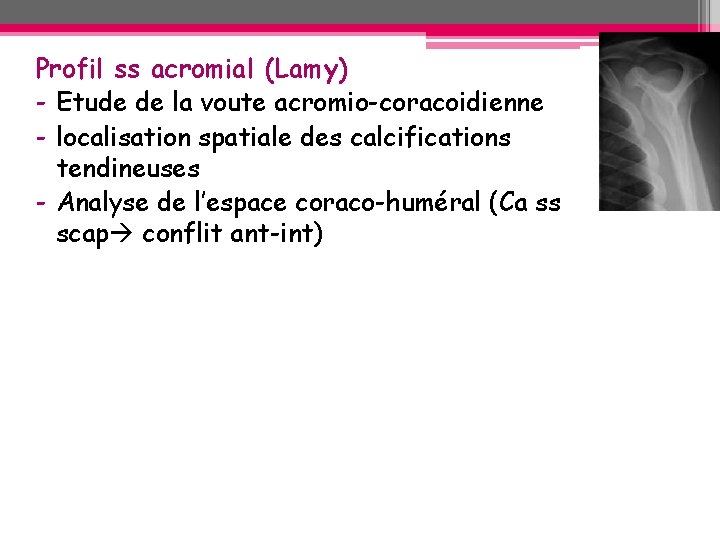 Profil ss acromial (Lamy) - Etude de la voute acromio-coracoidienne - localisation spatiale des Profil ss acromial (Lamy) - Etude de la voute acromio-coracoidienne - localisation spatiale des