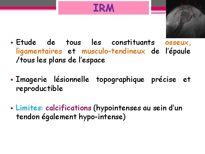 IRM • Etude de tous les constituants osseux, ligamentaires et musculo-tendineux de l’épaule /tous IRM • Etude de tous les constituants osseux, ligamentaires et musculo-tendineux de l’épaule /tous