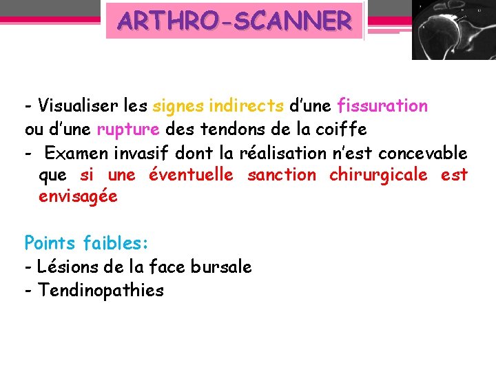 ARTHRO-SCANNER - Visualiser les signes indirects d’une fissuration ou d’une rupture des tendons de ARTHRO-SCANNER - Visualiser les signes indirects d’une fissuration ou d’une rupture des tendons de