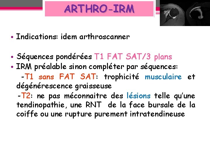 ARTHRO-IRM • Indications: idem arthroscanner • Séquences pondérées T 1 FAT SAT/3 plans • ARTHRO-IRM • Indications: idem arthroscanner • Séquences pondérées T 1 FAT SAT/3 plans •