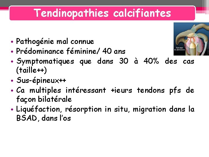 Tendinopathies calcifiantes • Pathogénie mal connue • Prédominance féminine/ 40 ans • Symptomatiques que Tendinopathies calcifiantes • Pathogénie mal connue • Prédominance féminine/ 40 ans • Symptomatiques que