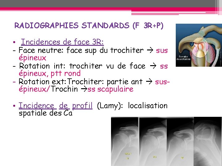 RADIOGRAPHIES STANDARDS (F 3 R+P) • Incidences de face 3 R: - Face neutre: RADIOGRAPHIES STANDARDS (F 3 R+P) • Incidences de face 3 R: - Face neutre: