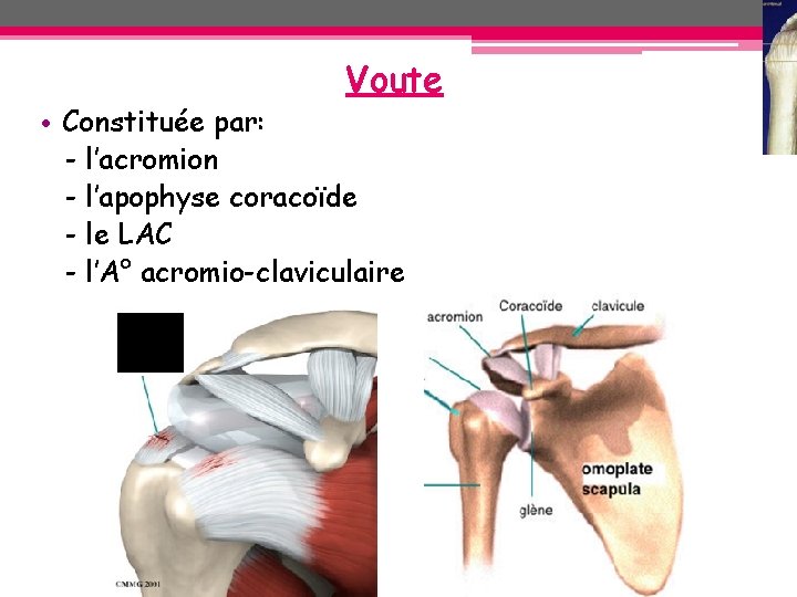 Voute • Constituée par: - l’acromion - l’apophyse coracoïde - le LAC - l’A° Voute • Constituée par: - l’acromion - l’apophyse coracoïde - le LAC - l’A°
