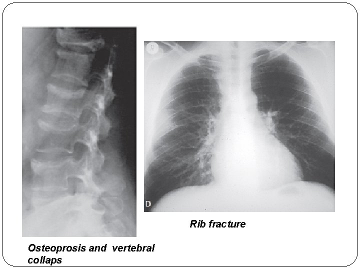 In The Name Of God Cushing Syndrome Epidemiology
