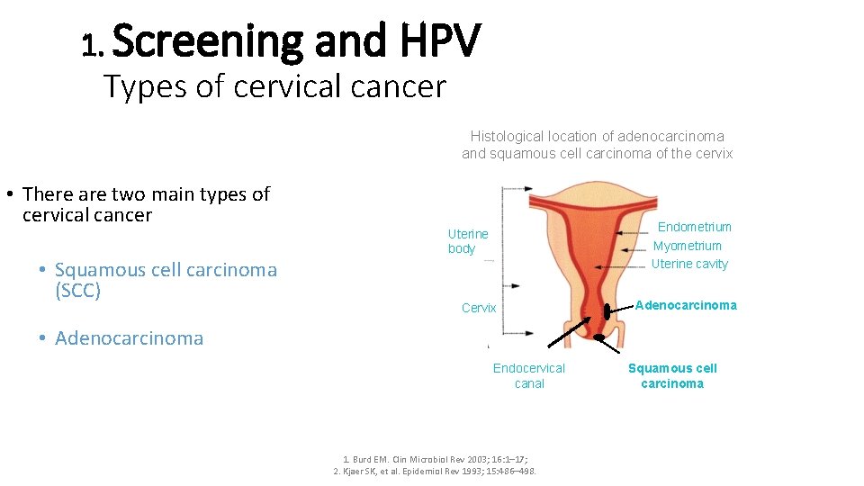 1. Screening and HPV Types of cervical cancer Histological location of adenocarcinoma and squamous