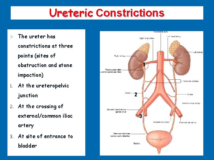 Ureteric Constrictions Ø The ureter has constrictions at three points (sites of obstruction and