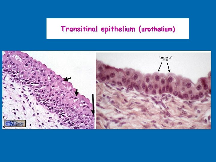 Transitinal epithelium (urothelium) 