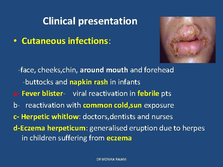 Clinical presentation • Cutaneous infections: -face, cheeks, chin, around mouth and forehead -buttocks and