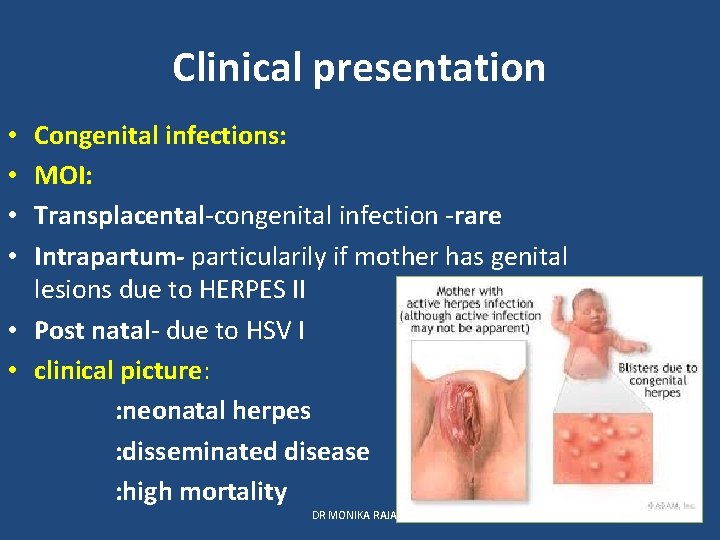 Clinical presentation Congenital infections: MOI: Transplacental-congenital infection -rare Intrapartum- particularily if mother has genital