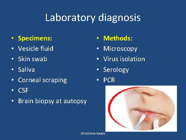 Laboratory diagnosis • • Specimens: Vesicle fluid Skin swab Saliva Corneal scraping CSF Brain