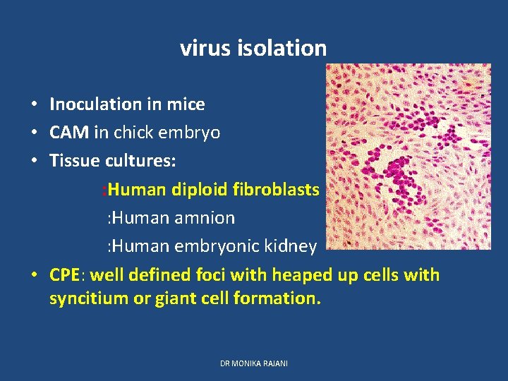 virus isolation • Inoculation in mice • CAM in chick embryo • Tissue cultures: