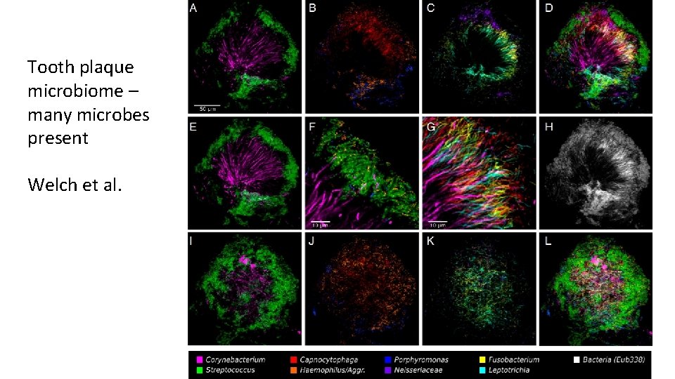 Tooth plaque microbiome – many microbes present Welch et al. 