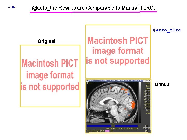 -30 - @auto_tlrc Results are Comparable to Manual TLRC: @auto_tlrc Original Manual 