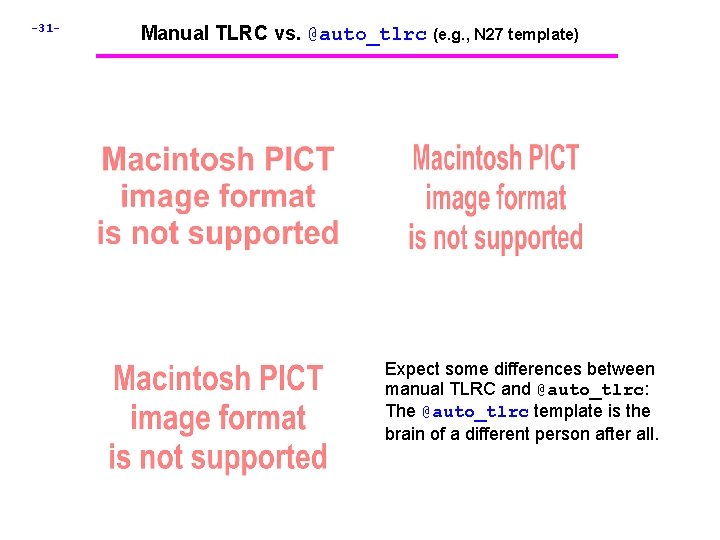 -31 - Manual TLRC vs. @auto_tlrc (e. g. , N 27 template) Expect some