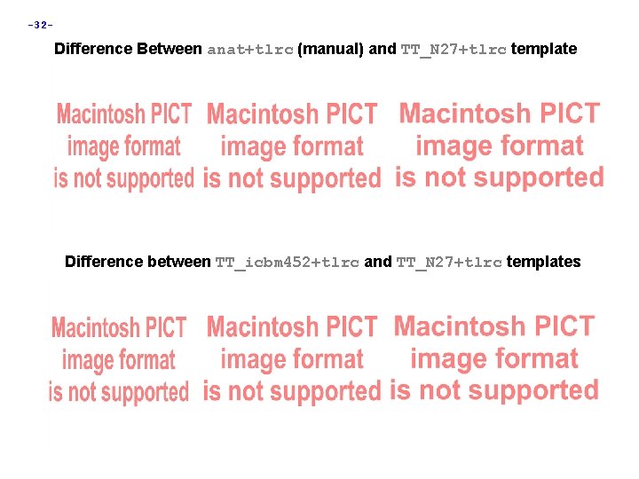 -32 - Difference Between anat+tlrc (manual) and TT_N 27+tlrc template Difference between TT_icbm 452+tlrc -32 - Difference Between anat+tlrc (manual) and TT_N 27+tlrc template Difference between TT_icbm 452+tlrc