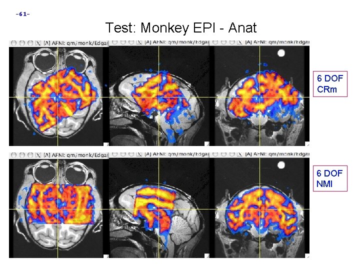 -61 - Test: Monkey EPI - Anat 6 DOF CRm 6 DOF NMI 