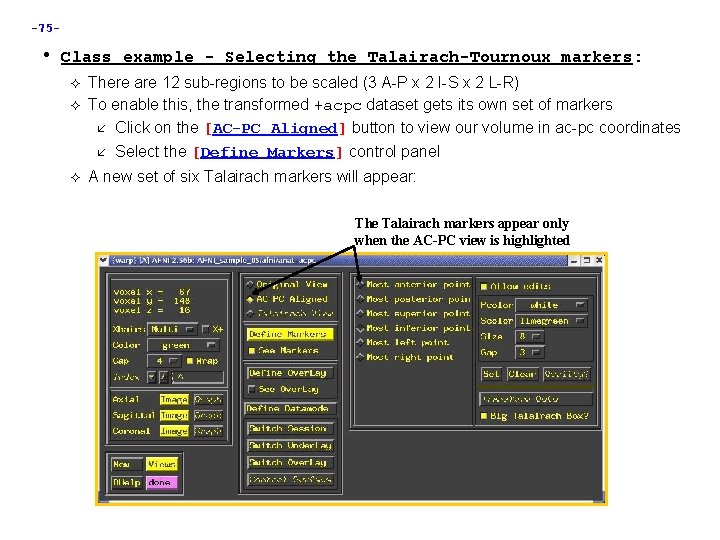 -75 - • Class example - Selecting the Talairach-Tournoux markers: There are 12 sub-regions