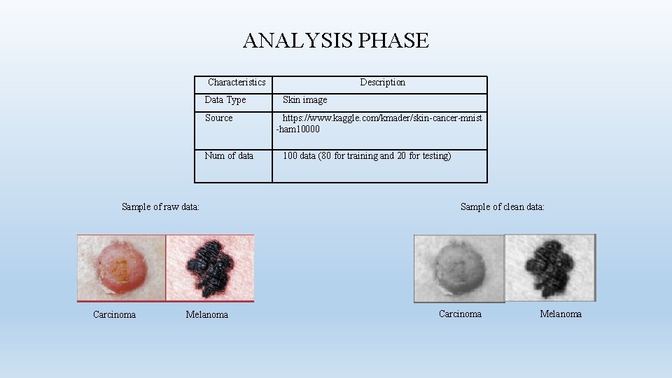 ANALYSIS PHASE Characteristics Data Type Source Num of data Sample of raw data: Carcinoma